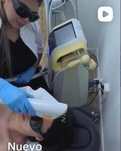 Sesion de laser en cabina